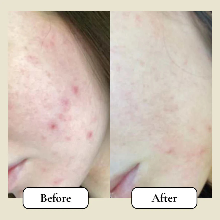 Re:Barrier™ Tallow Balm