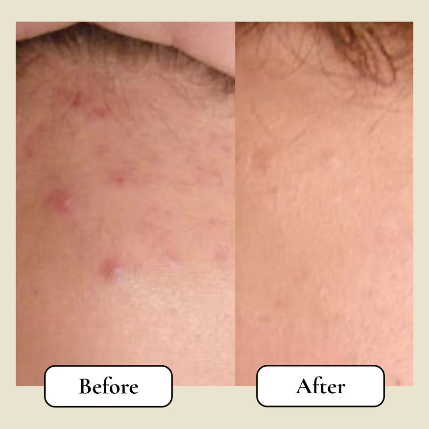 Re:Barrier™ Tallow Balm