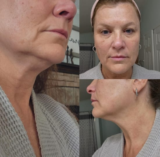 LymphaEase™ Contour Brush